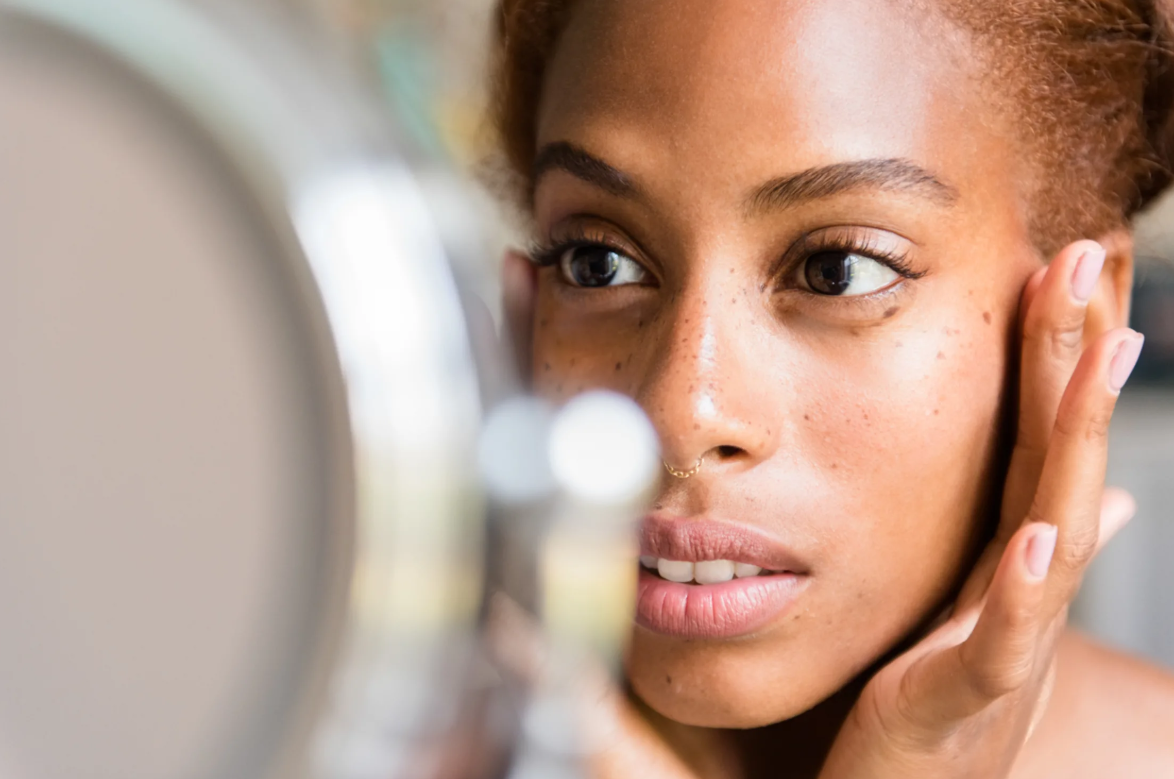 It's Acne Awareness Month: Why We Should Rethink How We Talk About Our Skin